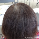 つむじ割れ 女性増毛2