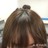 前髪女性 増毛エクステ1