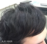 男性前髪 増毛2